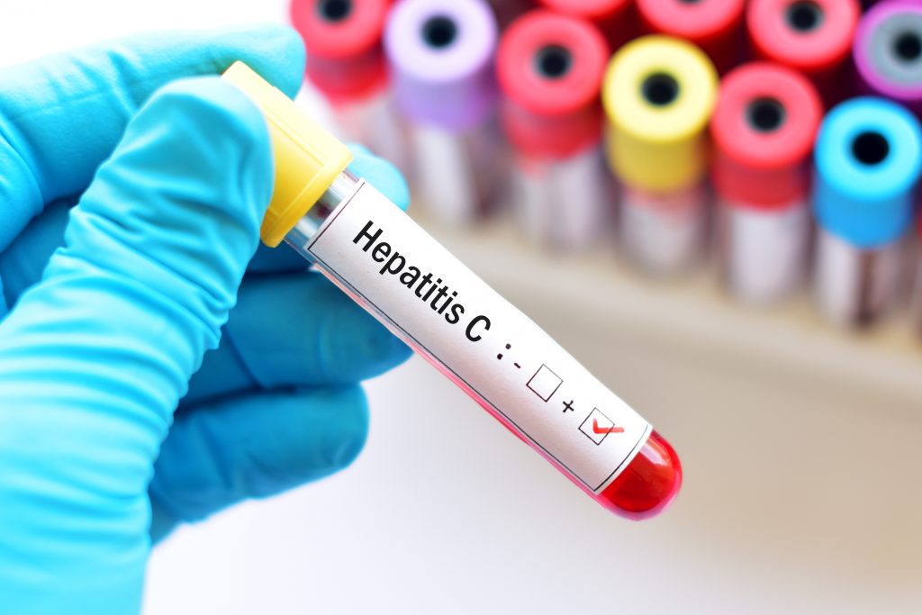 Hepatitis C - cause, symptoms and treatment