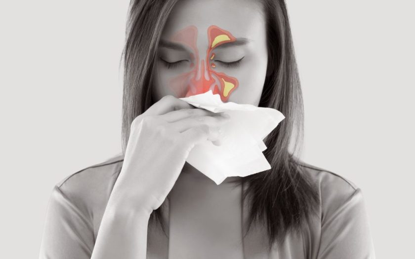 Sinusitis - symptoms and treatment